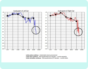 microaudiometria-aplicado-1024x811-1.png