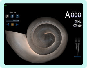 tinnitograma-aplicado-1024x811-1.png